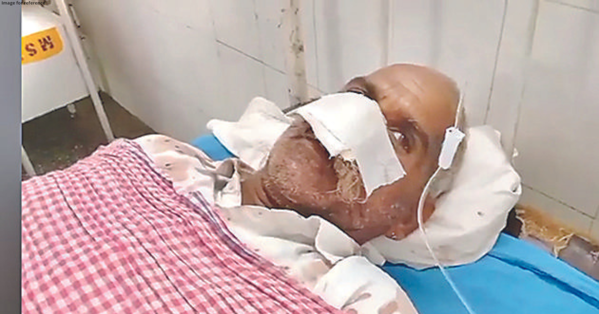 Man’s nose chopped off for declining daughter’s marriage
